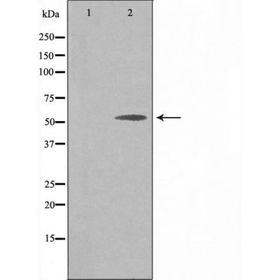 DF3515 at 1/100 staining Mouse pancreas tissue by IHC-P. The sample was formaldehyde fixed and a heat mediated antigen retrieval step in citrate buffer was performed. The sample was then blocked and incubated with the antibody for 1.5 hours at 22¡ãC. An HRP conjugated goat anti-rabbit antibody was used as the secondary