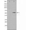 DF3515 at 1/100 staining Mouse pancreas tissue by IHC-P. The sample was formaldehyde fixed and a heat mediated antigen retrieval step in citrate buffer was performed. The sample was then blocked and incubated with the antibody for 1.5 hours at 22¡ãC. An HRP conjugated goat anti-rabbit antibody was used as the secondary