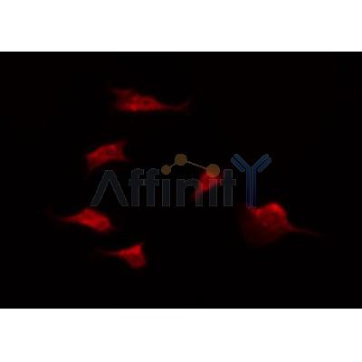 DF3526 staining Hela by IF/ICC. The sample were fixed with PFA and permeabilized in 0.1% Triton X-100,then blocked in 10% serum for 45 minutes at 25¡ãC. The primary antibody was diluted at 1/200 and incubated with the sample for 1 hour at 37¡ãC. An  Alexa Fluor 594 conjugated goat anti-rabbit IgG (H+L) Ab, diluted at 1/600, was used as the secondary antibod