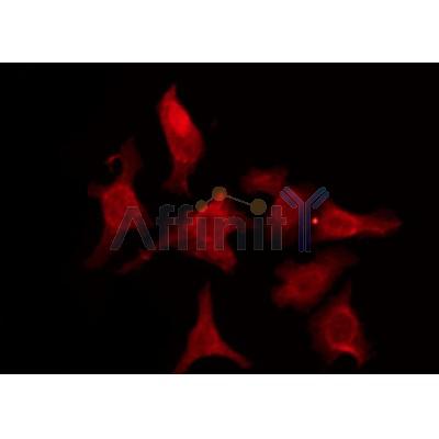 DF3527 staining HepG2 by IF/ICC. The sample were fixed with PFA and permeabilized in 0.1% Triton X-100,then blocked in 10% serum for 45 minutes at 25¡ãC. The primary antibody was diluted at 1/200 and incubated with the sample for 1 hour at 37¡ãC. An  Alexa Fluor 594 conjugated goat anti-rabbit IgG (H+L) Ab, diluted at 1/600, was used as the secondary antibod