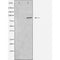 DF3528 staining HepG2 by IF/ICC. The sample were fixed with PFA and permeabilized in 0.1% Triton X-100,then blocked in 10% serum for 45 minutes at 25¡ãC. The primary antibody was diluted at 1/200 and incubated with the sample for 1 hour at 37¡ãC. An  Alexa Fluor 594 conjugated goat anti-rabbit IgG (H+L) Ab, diluted at 1/600, was used as the secondary antibod