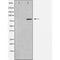 DF3529 staining HepG2 by IF/ICC. The sample were fixed with PFA and permeabilized in 0.1% Triton X-100,then blocked in 10% serum for 45 minutes at 25¡ãC. The primary antibody was diluted at 1/200 and incubated with the sample for 1 hour at 37¡ãC. An  Alexa Fluor 594 conjugated goat anti-rabbit IgG (H+L) Ab, diluted at 1/600, was used as the secondary antibod