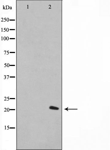 Western blot analysis on A549 cell lysate using Histone H1.0 Antibody,The lane on the left is treated with the antigen-specific peptide.