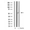 DF3535 staining HeLa by IF/ICC. The sample were fixed with PFA and permeabilized in 0.1% Triton X-100,then blocked in 10% serum for 45 minutes at 25¡ãC. The primary antibody was diluted at 1/200 and incubated with the sample for 1 hour at 37¡ãC. An  Alexa Fluor 594 conjugated goat anti-rabbit IgG (H+L) Ab, diluted at 1/600, was used as the secondary antibod