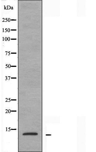 DF3681 staining  HuvEc cells by IF/ICC. The sample were fixed with PFA and permeabilized in 0.1% Triton X-100,then blocked in 10% serum for 45 minutes at 25¡ãC. The primary antibody was diluted at 1/200 and incubated with the sample for 1 hour at 37¡ãC. An  Alexa Fluor 594 conjugated goat anti-rabbit IgG (H+L) antibody(Cat.