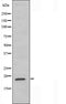 DF3683 staining  COLO205 cells by IF/ICC. The sample were fixed with PFA and permeabilized in 0.1% Triton X-100,then blocked in 10% serum for 45 minutes at 25¡ãC. The primary antibody was diluted at 1/200 and incubated with the sample for 1 hour at 37¡ãC. An  Alexa Fluor 594 conjugated goat anti-rabbit IgG (H+L) antibody(Cat.