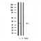 DF3685 staining  HeLa cells by IF/ICC. The sample were fixed with PFA and permeabilized in 0.1% Triton X-100,then blocked in 10% serum for 45 minutes at 25¡ãC. The primary antibody was diluted at 1/200 and incubated with the sample for 1 hour at 37¡ãC. An  Alexa Fluor 594 conjugated goat anti-rabbit IgG (H+L) antibody(Cat.# S0006), diluted at 1/600, was used as secondary antibod