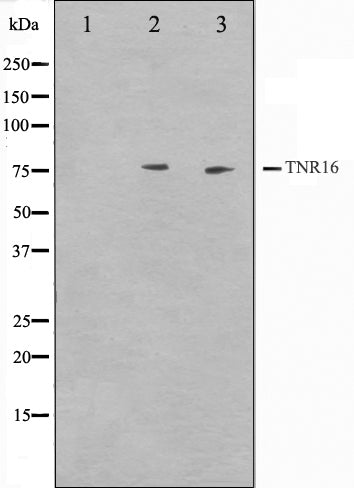 Western blot analysis on Jurkat and NIH-3T3 cell lysate using CD271 Antibody,The lane on the left is treated with the antigen-specific peptide.