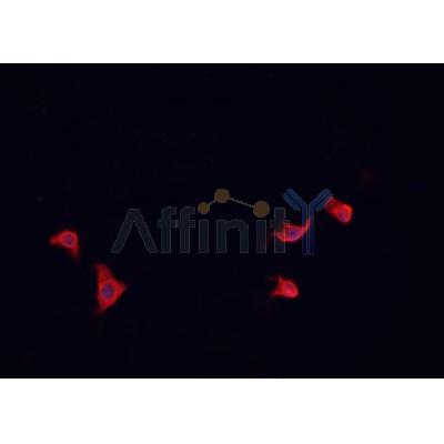 AF0360 staining U-2 OS cells by IF/ICC. The sample were fixed with PFA and permeabilized in 0.1% Triton X-100,then blocked in 10% serum for 45 minutes at 25¡ãC. The primary antibody was diluted at 1/200 and incubated with the sample for 1 hour at 37¡ãC. An  Alexa Fluor 594 conjugated goat anti-rabbit IgG (H+L) antibody(Cat.