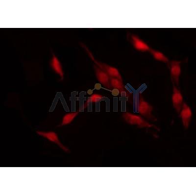 AF0360 staining HepG2 by IF/ICC. The sample were fixed with PFA and permeabilized in 0.1% Triton X-100,then blocked in 10% serum for 45 minutes at 25¡ãC. The primary antibody was diluted at 1/200 and incubated with the sample for 1 hour at 37¡ãC. An  Alexa Fluor 594 conjugated goat anti-rabbit IgG (H+L) Ab, diluted at 1/600, was used as the secondary antibod