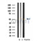 DF3774 staining Hela by IF/ICC. The sample were fixed with PFA and permeabilized in 0.1% Triton X-100,then blocked in 10% serum for 45 minutes at 25¡ãC. The primary antibody was diluted at 1/200 and incubated with the sample for 1 hour at 37¡ãC. An  Alexa Fluor 594 conjugated goat anti-rabbit IgG (H+L) Ab, diluted at 1/600, was used as the secondary antibod