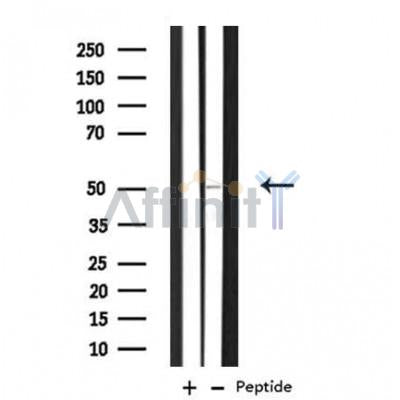 DF3774 staining Hela by IF/ICC. The sample were fixed with PFA and permeabilized in 0.1% Triton X-100,then blocked in 10% serum for 45 minutes at 25¡ãC. The primary antibody was diluted at 1/200 and incubated with the sample for 1 hour at 37¡ãC. An  Alexa Fluor 594 conjugated goat anti-rabbit IgG (H+L) Ab, diluted at 1/600, was used as the secondary antibod