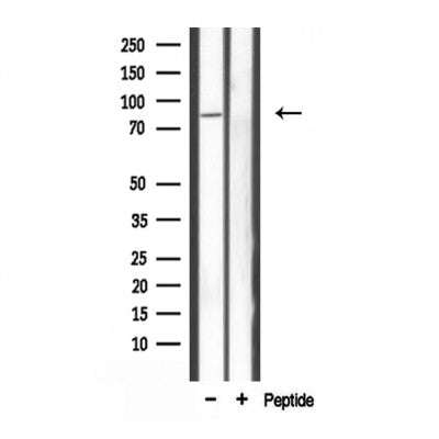 DF3775 at 1/100 staining Human breast cancer tissue by IHC-P. The sample was formaldehyde fixed and a heat mediated antigen retrieval step in citrate buffer was performed. The sample was then blocked and incubated with the antibody for 1.5 hours at 22¡ãC. An HRP conjugated goat anti-rabbit antibody was used as the secondary