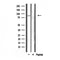 DF3775 at 1/100 staining Human breast cancer tissue by IHC-P. The sample was formaldehyde fixed and a heat mediated antigen retrieval step in citrate buffer was performed. The sample was then blocked and incubated with the antibody for 1.5 hours at 22¡ãC. An HRP conjugated goat anti-rabbit antibody was used as the secondary