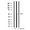 DF3778 staining Hela by IF/ICC. The sample were fixed with PFA and permeabilized in 0.1% Triton X-100,then blocked in 10% serum for 45 minutes at 25¡ãC. The primary antibody was diluted at 1/200 and incubated with the sample for 1 hour at 37¡ãC. An  Alexa Fluor 594 conjugated goat anti-rabbit IgG (H+L) Ab, diluted at 1/600, was used as the secondary antibod