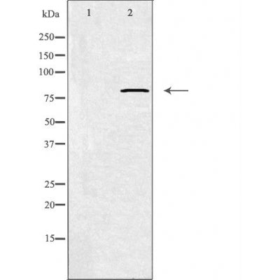 DF3867 staining HepG2 by IF/ICC. The sample were fixed with PFA and permeabilized in 0.1% Triton X-100,then blocked in 10% serum for 45 minutes at 25¡ãC. The primary antibody was diluted at 1/200 and incubated with the sample for 1 hour at 37¡ãC. An  Alexa Fluor 594 conjugated goat anti-rabbit IgG (H+L) Ab, diluted at 1/600, was used as the secondary antibod