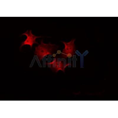 AF0361 staining COLO205 by IF/ICC. The sample were fixed with PFA and permeabilized in 0.1% Triton X-100,then blocked in 10% serum for 45 minutes at 25¡ãC. The primary antibody was diluted at 1/200 and incubated with the sample for 1 hour at 37¡ãC. An  Alexa Fluor 594 conjugated goat anti-rabbit IgG (H+L) Ab, diluted at 1/600, was used as the secondary antibod