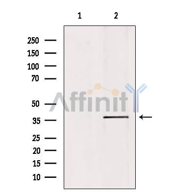 Western blot analysis of extracts from mouse brain, using KAPC A/B Antibody. Lane 1 was treated with the blocking peptide.