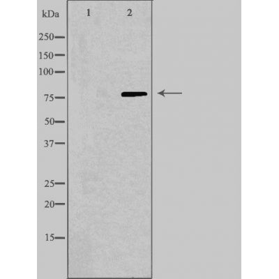 DF3869 staining HuvEc by IF/ICC. The sample were fixed with PFA and permeabilized in 0.1% Triton X-100,then blocked in 10% serum for 45 minutes at 25¡ãC. The primary antibody was diluted at 1/200 and incubated with the sample for 1 hour at 37¡ãC. An  Alexa Fluor 594 conjugated goat anti-rabbit IgG (H+L) Ab, diluted at 1/600, was used as the secondary antibod