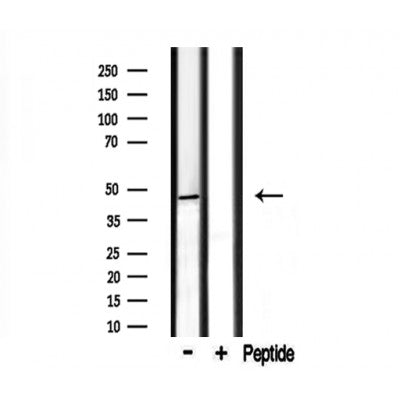 Western blot analysis of extracts from HepG2,mouse brain, using CADM2 Antibody.
