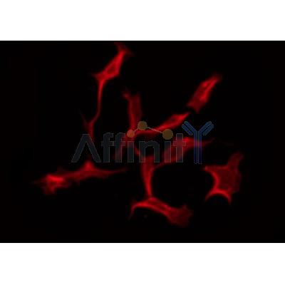 DF3537 staining Hela by IF/ICC. The sample were fixed with PFA and permeabilized in 0.1% Triton X-100,then blocked in 10% serum for 45 minutes at 25¡ãC. The primary antibody was diluted at 1/200 and incubated with the sample for 1 hour at 37¡ãC. An  Alexa Fluor 594 conjugated goat anti-rabbit IgG (H+L) Ab, diluted at 1/600, was used as the secondary antibod