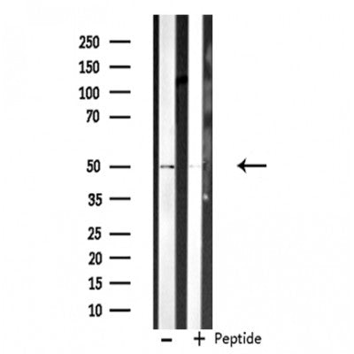 DF3542 staining Hela cells by IF/ICC. The sample were fixed with PFA and permeabilized in 0.1% Triton X-100,then blocked in 10% serum for 45 minutes at 25¡ãC. The primary antibody was diluted at 1/200 and incubated with the sample for 1 hour at 37¡ãC. An  Alexa Fluor 594 conjugated goat anti-rabbit IgG (H+L) antibody(Cat.# S0006), diluted at 1/600, was used as secondary antibod
