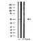 DF3542 staining Hela cells by IF/ICC. The sample were fixed with PFA and permeabilized in 0.1% Triton X-100,then blocked in 10% serum for 45 minutes at 25¡ãC. The primary antibody was diluted at 1/200 and incubated with the sample for 1 hour at 37¡ãC. An  Alexa Fluor 594 conjugated goat anti-rabbit IgG (H+L) antibody(Cat.# S0006), diluted at 1/600, was used as secondary antibod