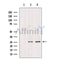 Western blot analysis of extracts from various samples, using TSPAN8 Antibody.
 Lane 1: 293 treated with blocking peptide.
 Lane 2: 293;
 Lane 3: HUVEC;
 
