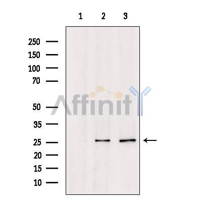 Western blot analysis of extracts from various samples, using TSPAN8 Antibody.
 Lane 1: 293 treated with blocking peptide.
 Lane 2: 293;
 Lane 3: HUVEC;
 