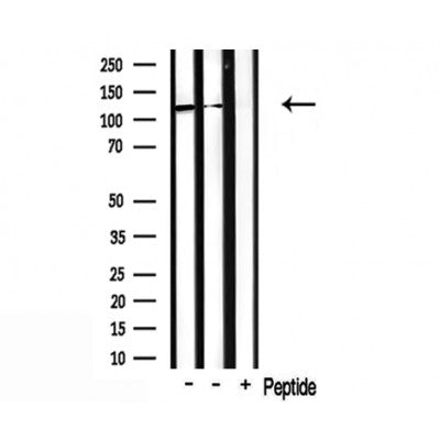 Western blot analysis of extracts from rat brain, using CDCA2 Antibody. Lane 1 was treated with the antigen-specific peptide.