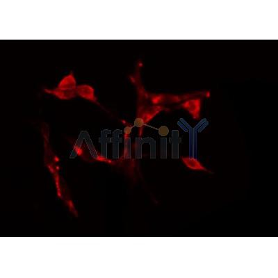 DF3545 staining Hela by IF/ICC. The samples were fixed with PFA and permeabilized in 0.1% Triton X-100,then blocked in 10% serum for 45 minutes at 25¡ãC. Samples were then incubated with primary Ab(DF3545 1:200) and mouse anti-beta tubulin Ab(T0023 1:200) for 1 hour at 37¡ãC. An  AlexaFluor594 conjugated goat anti-rabbit IgG(H+L) Ab(S0006 Red 1:600) and an AlexaFluor488 conjugated goat anti-mouse IgG(H+L) Ab(S0017 Green 1:600) were used as the secondary antibod