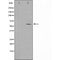 DF3547 staining  293 cells by IF/ICC. The sample were fixed with PFA and permeabilized in 0.1% Triton X-100,then blocked in 10% serum for 45 minutes at 25¡ãC. The primary antibody was diluted at 1/200 and incubated with the sample for 1 hour at 37¡ãC. An  Alexa Fluor 594 conjugated goat anti-rabbit IgG (H+L) antibody(Cat.