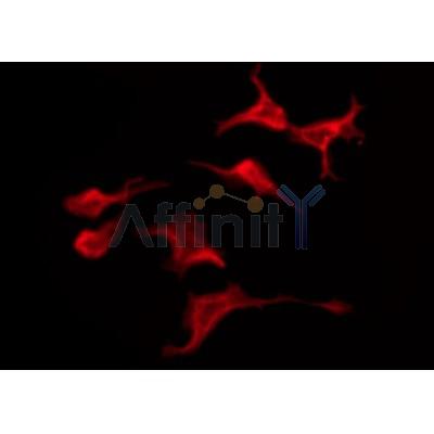 Western blot analysis of extracts from mouse brain, using CMKLR1 Antibody.