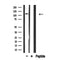 Western blot analysis of extracts from HepG2, using Collagen I ?2 Antibody.