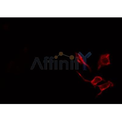 Western blot analysis of extracts from rat brain, using Collagen IV ?2 Antibody. Lane 1 was treated with the antigen-specific peptide.