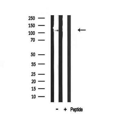 Western blot analysis of extracts from HepG2, using Collagen VI ?2 Antibody.
