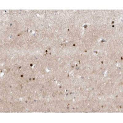 AF0363 at 1/100 staining human brain tissue sections by IHC-P. The tissue was formaldehyde fixed and a heat mediated antigen retrieval step in citrate buffer was performed. The tissue was then blocked and incubated with the antibody for 1.5 hours at 22¡ãC. An HRP conjugated goat anti-rabbit antibody was used as the secondary