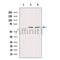 Western blot analysis of extracts from various samples, using TFE3 Antibody.
 Lane 1: Mouse cancer treated with blocking peptide.
 Lane 2: Mouse cancer;
 Lane 3: hela;
 
