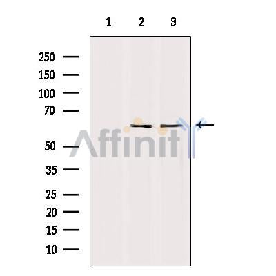 Western blot analysis of extracts from various samples, using TFE3 Antibody.
 Lane 1: Mouse cancer treated with blocking peptide.
 Lane 2: Mouse cancer;
 Lane 3: hela;
 