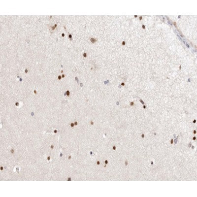 AF0201 at 1/100 staining human brain tissue sections by IHC-P. The tissue was formaldehyde fixed and a heat mediated antigen retrieval step in citrate buffer was performed. The tissue was then blocked and incubated with the antibody for 1.5 hours at 22¡ãC. An HRP conjugated goat anti-rabbit antibody was used as the secondary