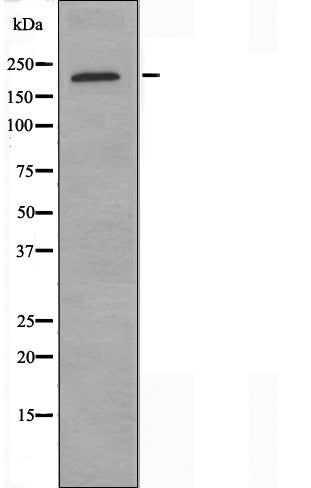 DF3553 staining Hela cells by IF/ICC. The sample were fixed with PFA and permeabilized in 0.1% Triton X-100,then blocked in 10% serum for 45 minutes at 25¡ãC. The primary antibody was diluted at 1/200 and incubated with the sample for 1 hour at 37¡ãC. An  Alexa Fluor 594 conjugated goat anti-rabbit IgG (H+L) antibody(Cat.# S0006), diluted at 1/600, was used as secondary antibod