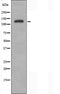 DF3555 at 1/100 staining Mouse testis tissue by IHC-P. The sample was formaldehyde fixed and a heat mediated antigen retrieval step in citrate buffer was performed. The sample was then blocked and incubated with the antibody for 1.5 hours at 22¡ãC. An HRP conjugated goat anti-rabbit antibody was used as the secondary