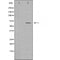 DF3556 staining  Hela cells by IF/ICC. The sample were fixed with PFA and permeabilized in 0.1% Triton X-100,then blocked in 10% serum for 45 minutes at 25¡ãC. The primary antibody was diluted at 1/200 and incubated with the sample for 1 hour at 37¡ãC. An  Alexa Fluor 594 conjugated goat anti-rabbit IgG (H+L) antibody(Cat.# S0006), diluted at 1/600, was used as secondary antibod