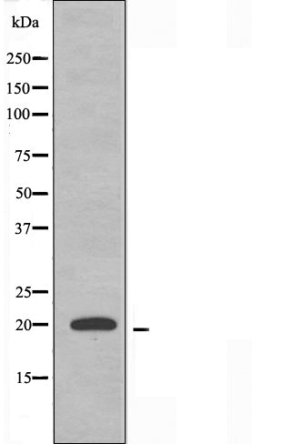 DF3560 staining Hela by IF/ICC. The sample were fixed with PFA and permeabilized in 0.1% Triton X-100,then blocked in 10% serum for 45 minutes at 25¡ãC. The primary antibody was diluted at 1/200 and incubated with the sample for 1 hour at 37¡ãC. An  Alexa Fluor 594 conjugated goat anti-rabbit IgG (H+L) Ab, diluted at 1/600, was used as the secondary antibod