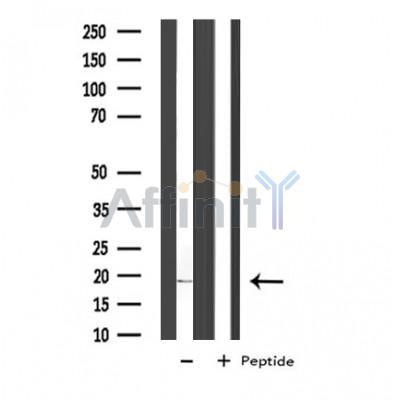 Western blot analysis of extracts from HepG2, using COX5A Antibody. Lane 1 was treated with the antigen-specific peptide.