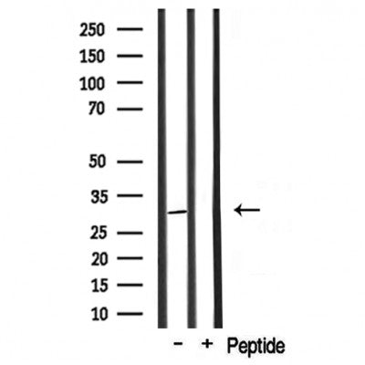 DF3562 staining HuvEc by IF/ICC. The sample were fixed with PFA and permeabilized in 0.1% Triton X-100,then blocked in 10% serum for 45 minutes at 25¡ãC. The primary antibody was diluted at 1/200 and incubated with the sample for 1 hour at 37¡ãC. An  Alexa Fluor 594 conjugated goat anti-rabbit IgG (H+L) Ab, diluted at 1/600, was used as the secondary antibod