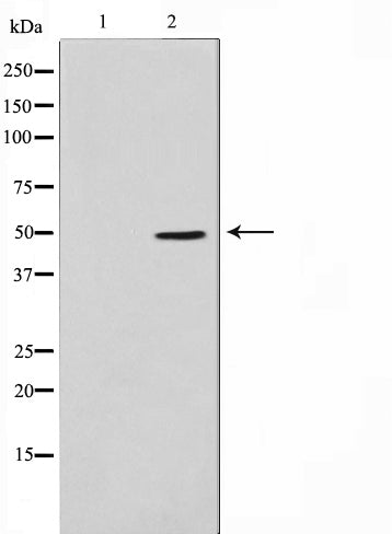 Western blot analysis on LOVO cell lysate using TNF-R2 Antibody,The lane on the left is treated with the antigen-specific peptide.