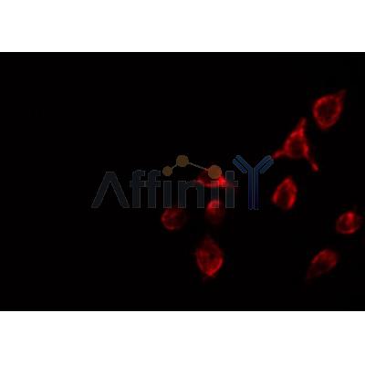 AF0364 staining RAW264.7 by IF/ICC. The sample were fixed with PFA and permeabilized in 0.1% Triton X-100,then blocked in 10% serum for 45 minutes at 25¡ãC. The primary antibody was diluted at 1/200 and incubated with the sample for 1 hour at 37¡ãC. An  Alexa Fluor 594 conjugated goat anti-rabbit IgG (H+L) Ab, diluted at 1/600, was used as the secondary antibod