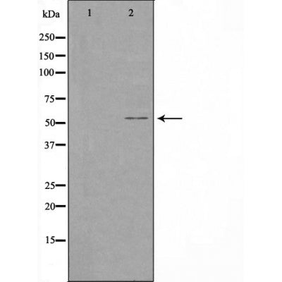 DF3565 staining  Hela cells by IF/ICC. The sample were fixed with PFA and permeabilized in 0.1% Triton X-100,then blocked in 10% serum for 45 minutes at 25¡ãC. The primary antibody was diluted at 1/200 and incubated with the sample for 1 hour at 37¡ãC. An  Alexa Fluor 594 conjugated goat anti-rabbit IgG (H+L) antibody(Cat.# S0006), diluted at 1/600, was used as secondary antibod