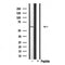Western blot analysis of extracts from Myeloma cells, using Cytochrome P450 1A2 Antibody. Lane 1 was treated with the antigen-specific peptide.